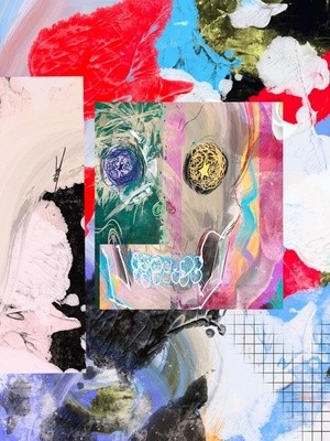 Migraines/ Mild Headaches