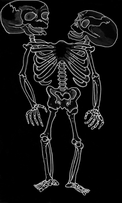 siamese death