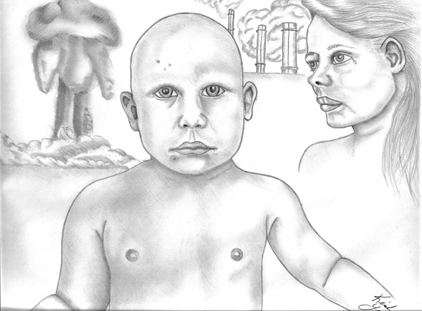 Alopecia