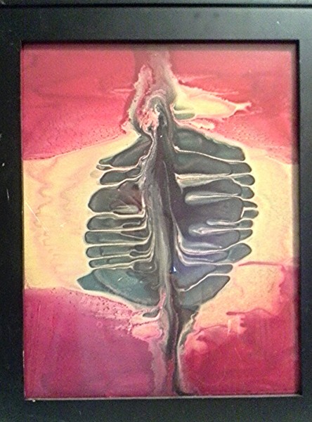 spinal