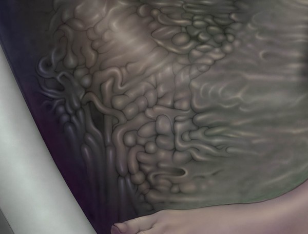 6th detail: no title yet