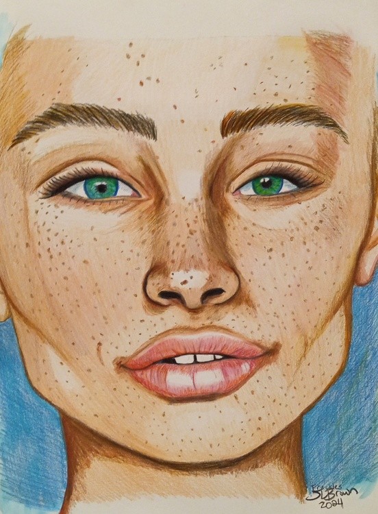 Freckles