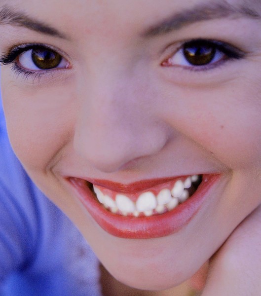 Teeth Whitening Campaign Photo
