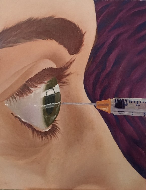 Eye of the Needle