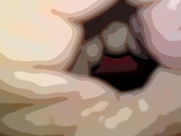 black hole