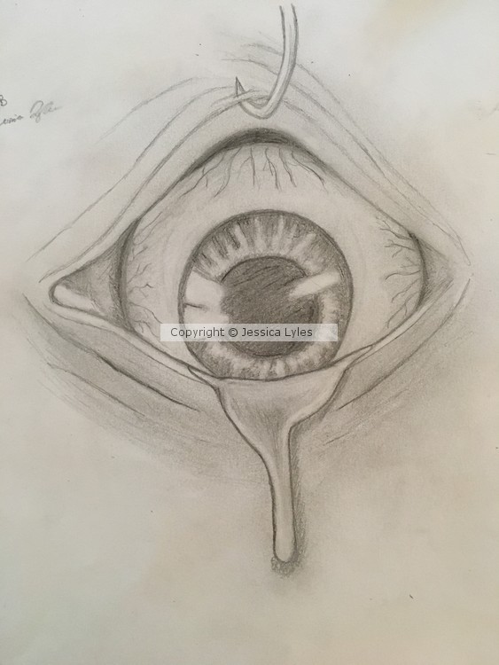 The eye