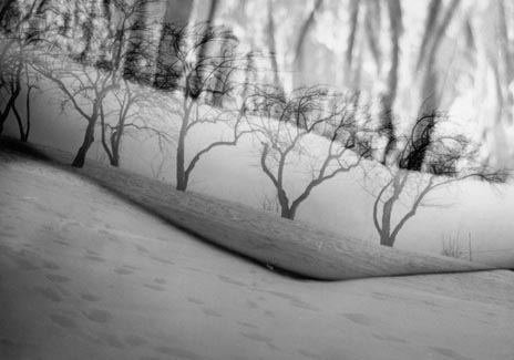 Veins