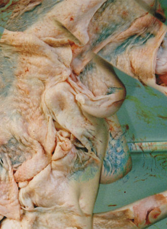 Skin Beautiful II