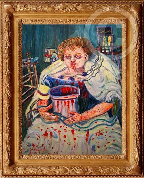 Surgery