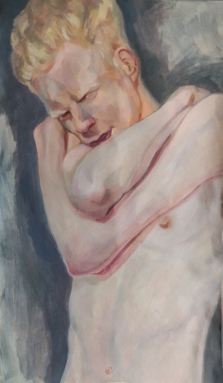 Albino Boy