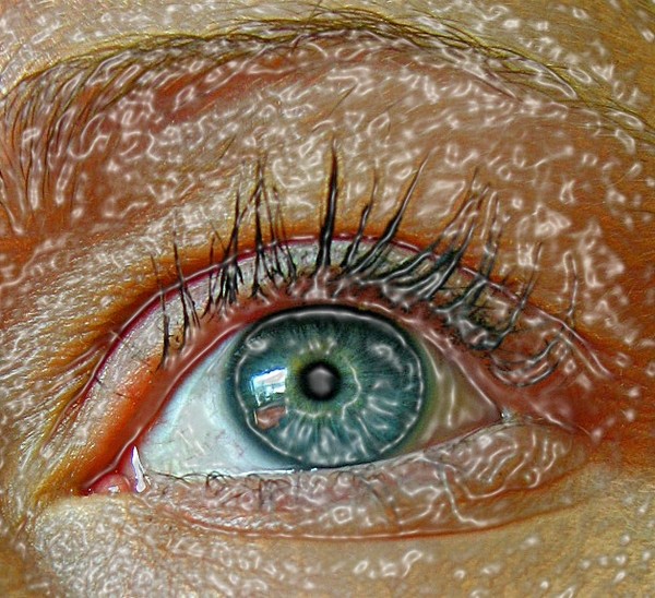 visine