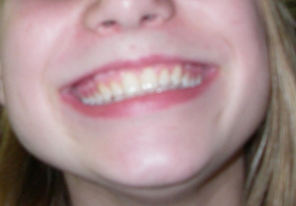 Smile