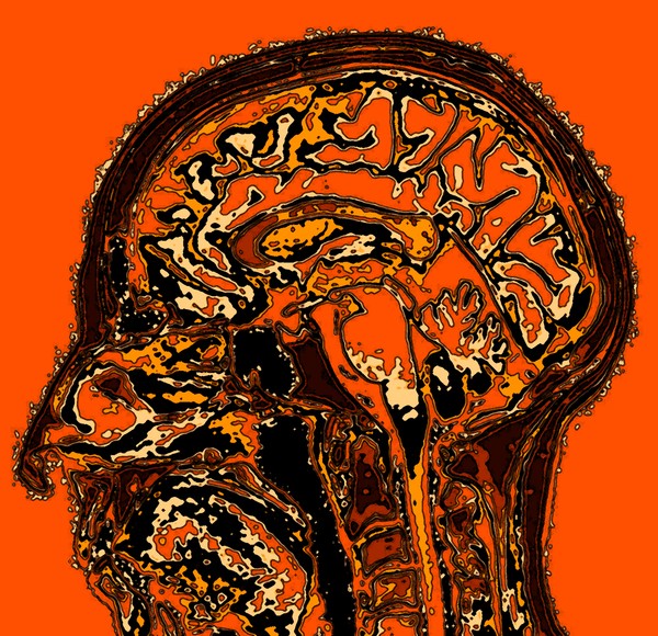 Brain in Orange