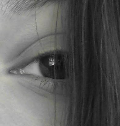 Eye
