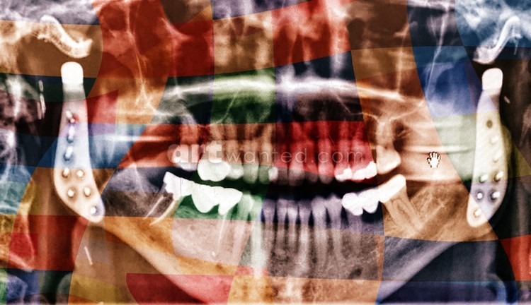 Jaws