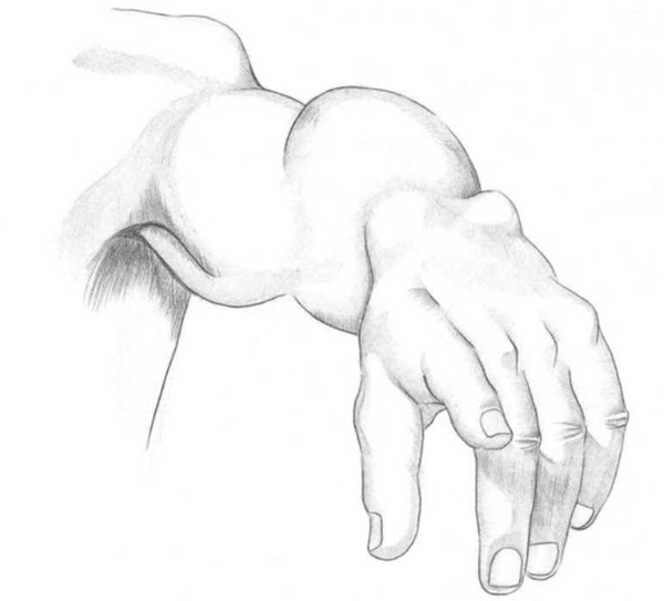 Arm