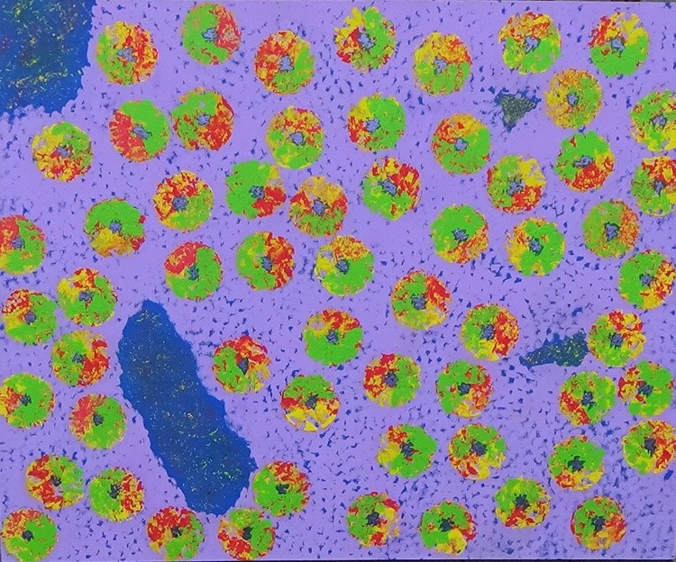 PAPILLOMA