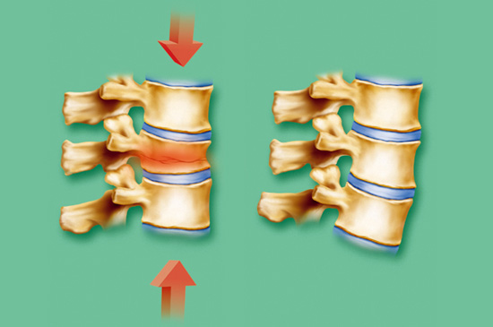 Spine

