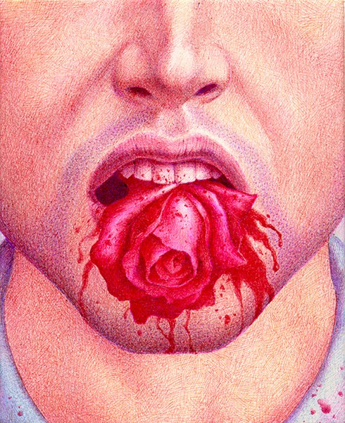 Tuberculosis