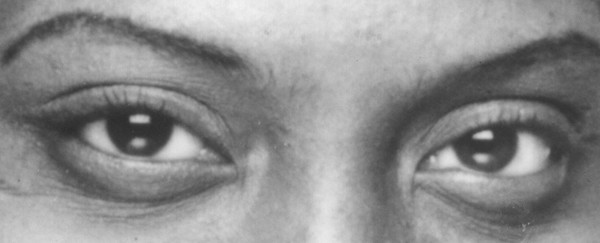 Eyes have it series