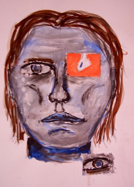 Achilles heel