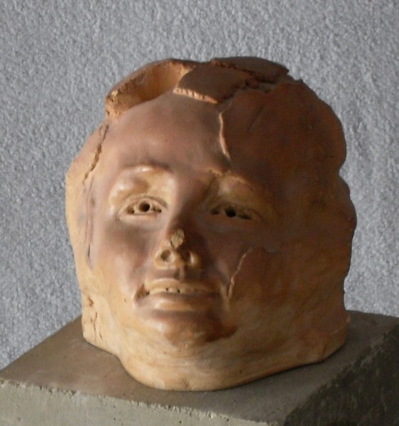 Smiling child with broken nose