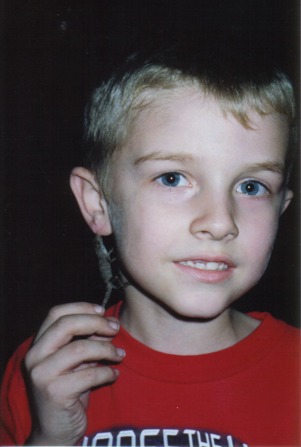 Lizard Boy