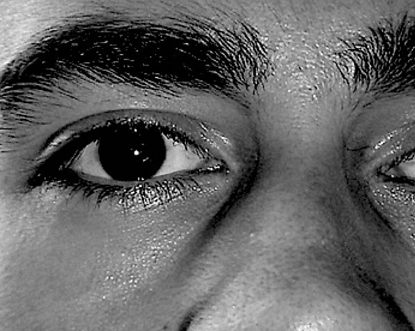 big eye