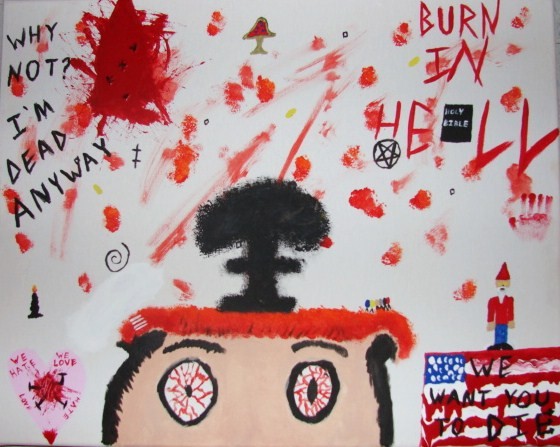 I Melted My Brains ... In An Acid Accident