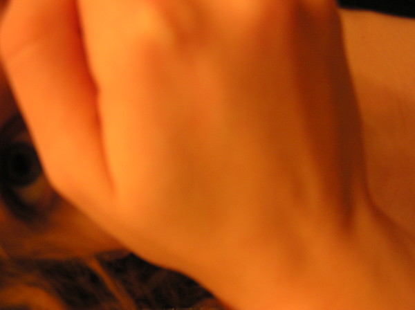 image 2 from Skin Series