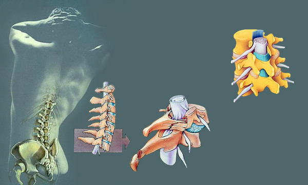 SPINAL_copy