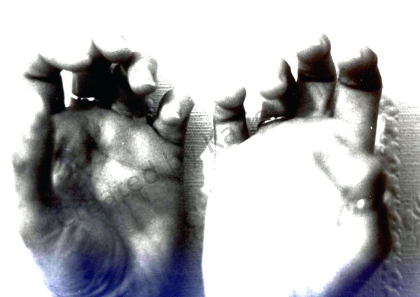 A Last Grasp