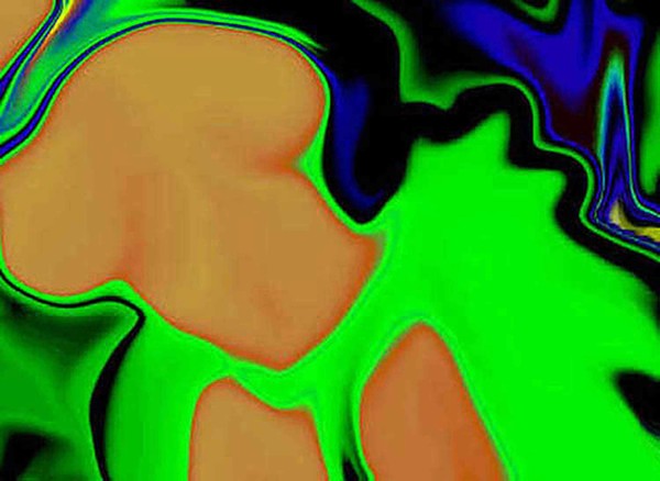 Woman's Body