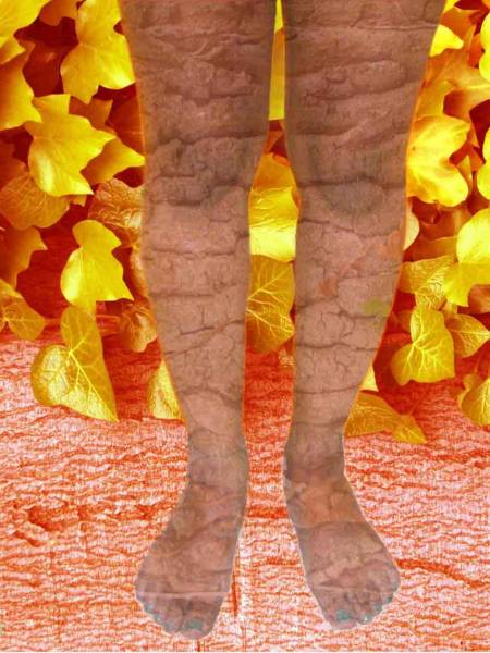 Dream Legs