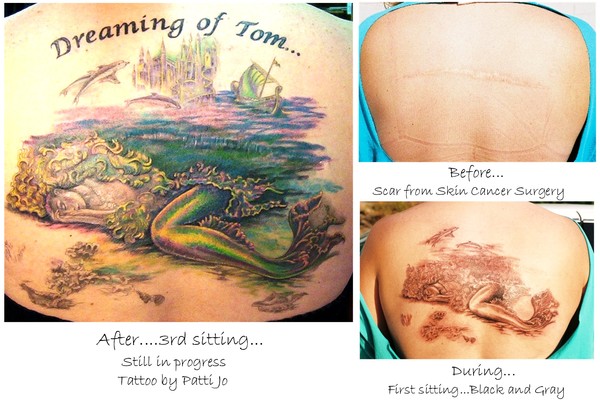 Tattoo Covers Cancer Scar