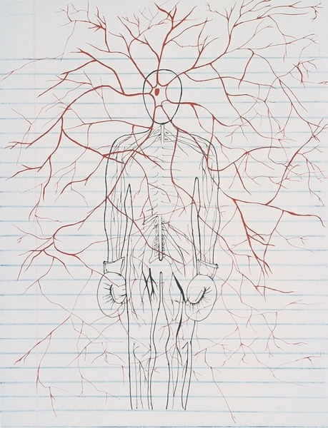 Headache