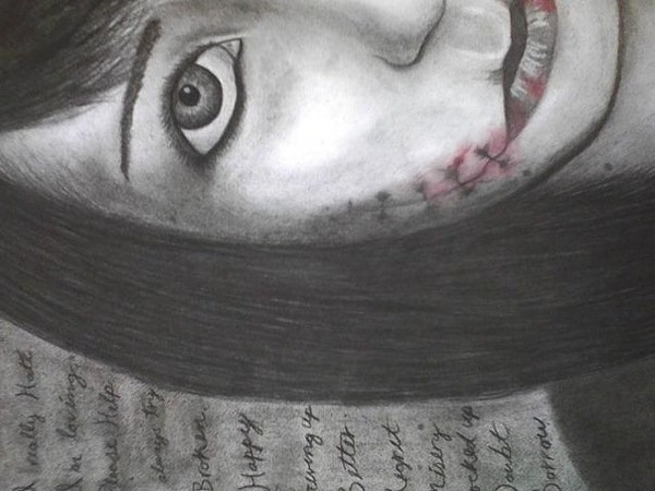 Scars
