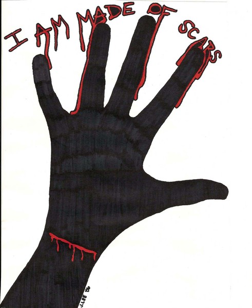 I Am Made of Scars