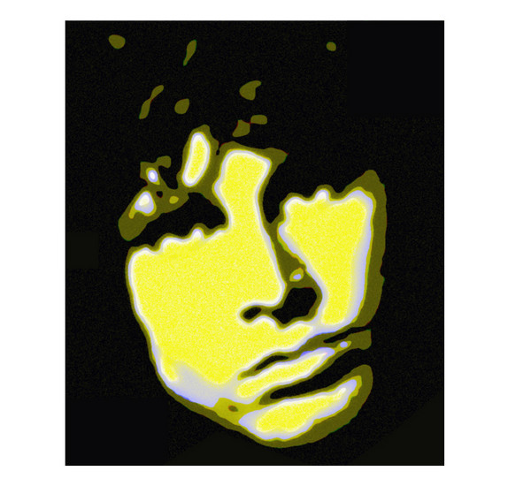 JIM