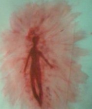 Aura