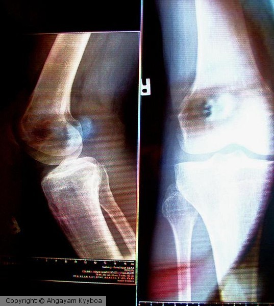 Xray Bones and Beauty