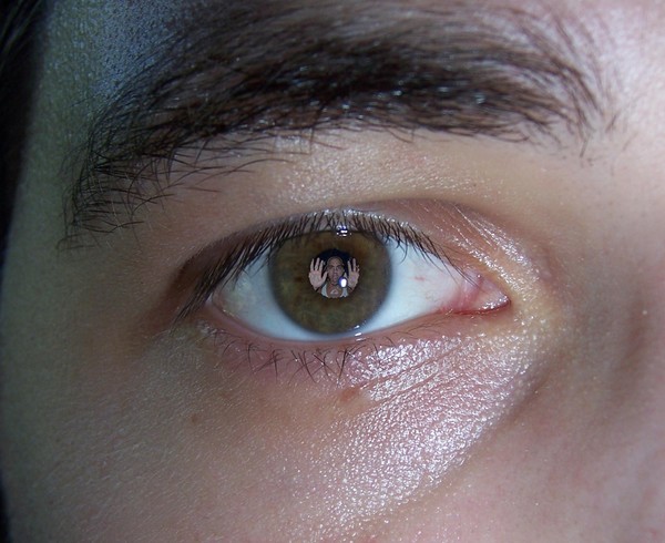 something in my eye