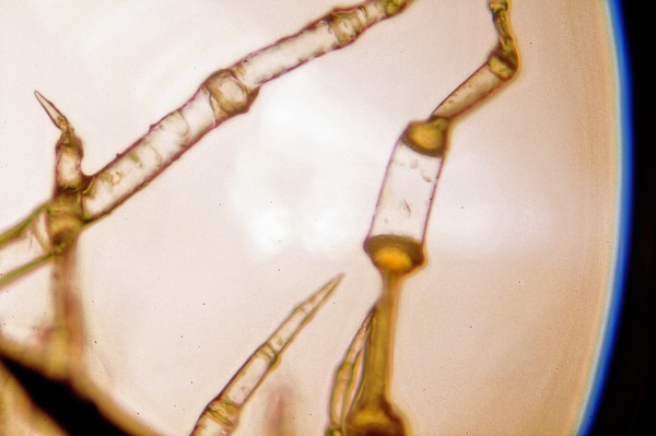 Plant hair through the Microscope