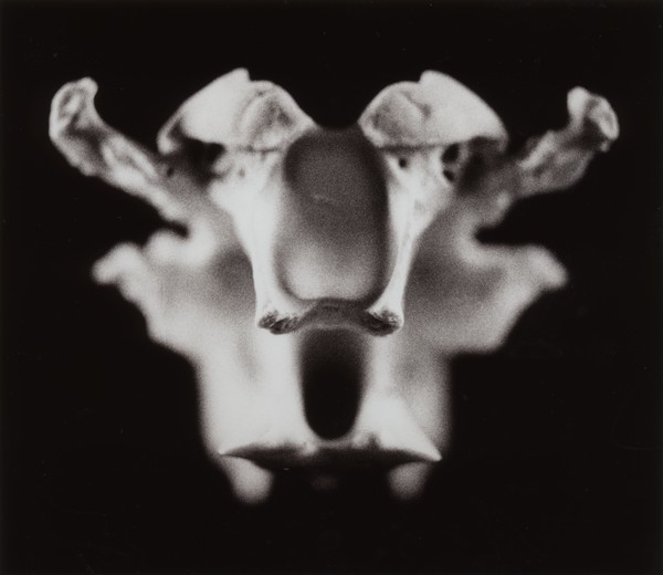 Bone abstract #4