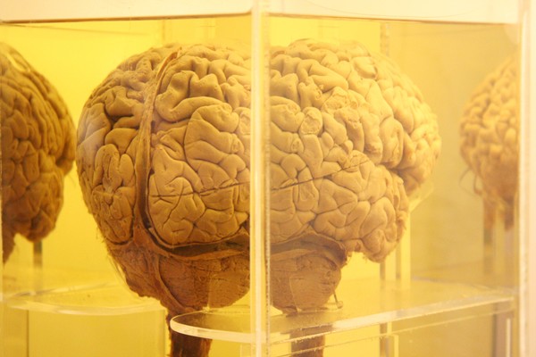Brain