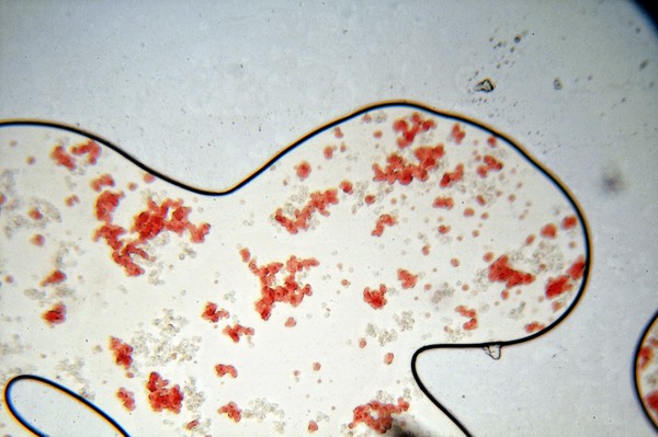 My Blood all Ameba looking