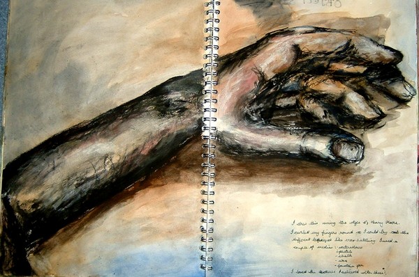 Arm