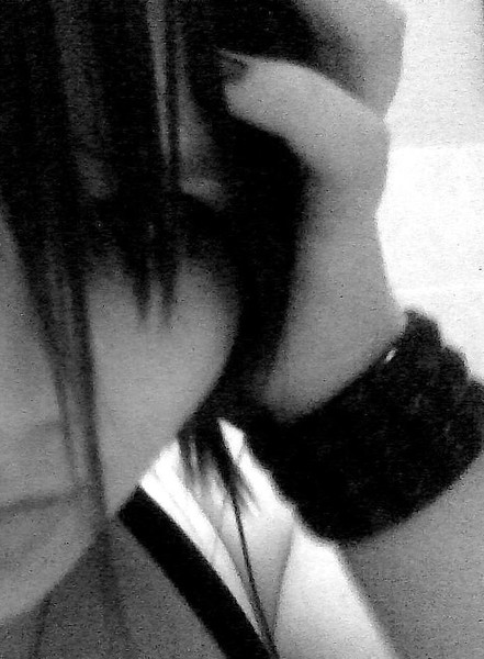black eye