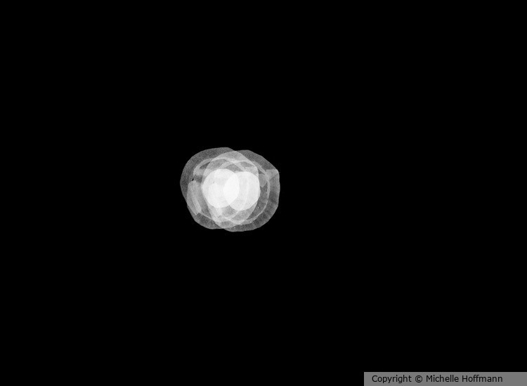 Embryo