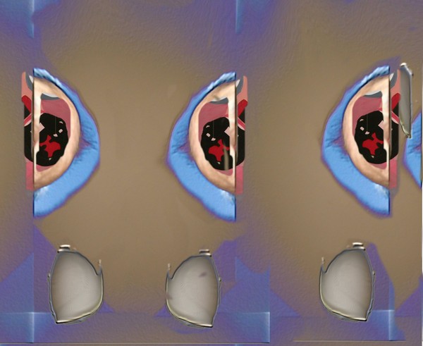 slices